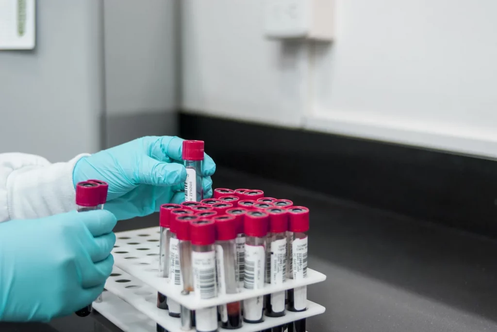 Corona-Testlabor im GRG Hygiene Mobil mit professioneller Ausstattung für sichere Testergebnisse